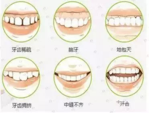 上海牙科哪里便宜又好?这几家医院种植牙/矫正/补牙专业又实惠